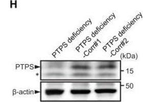 Gene correction of variant in BH4 metabolism disorder iPSCs.