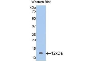 Detection of Recombinant S100, Rat using Polyclonal Antibody to S100 Calcium Binding Protein (S100) (S100 Protein (S100) (AA 1-94) anticorps)
