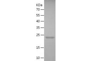 Western Blotting (WB) image for Caspase 4, Apoptosis-Related Cysteine Peptidase (CASP4) (AA 80-270) protein (His tag) (ABIN7122167)