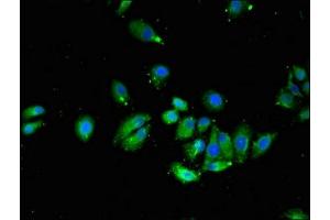 anti-Vesicle Transport through Interaction with t-SNAREs 1A (VTI1A) (AA 1-175) antibody