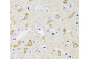 Immunohistochemistry of paraffin-embedded Mouse brain using HSPH1 Polyclonal Antibody at dilution of 1:100 (40x lens). (HSPH1 anticorps)