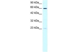 Western Blotting (WB) image for anti-Suppressor of Ty 3 Homolog (SUPT3H) antibody (ABIN2460155) (SUPT3H/SPT3 anticorps)