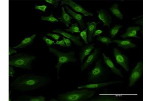 Immunofluorescence of monoclonal antibody to GLI1 on HeLa cell.