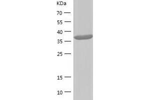 Western Blotting (WB) image for SUMO1 Activating Enzyme Subunit 1 (SAE1) (AA 1-346) protein (His tag) (ABIN7125243)