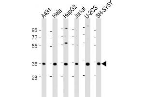 All lanes : Anti-NT5C3 Antibody (C-Term) at 1:2000 dilution Lane 1: A431 whole cell lysate Lane 2: Hela whole cell lysate Lane 3: HepG2 whole cell lysate Lane 4: Jurkat whole cell lysate Lane 5: U-2OS whole cell lysate Lane 6: SH-SY5Y whole cell lysate Lysates/proteins at 20 μg per lane.