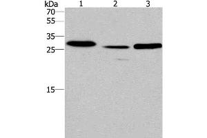 Western Blot analysis of Human fetal liver tissue and Mouse heart tissue,Human testis tissue using IRAK1BP1 Polyclonal Antibody at dilution of 1:475 (IRAK1BP1 anticorps)