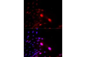 Immunofluorescence analysis of U2OS cells using DDB2 antibody (ABIN5970947). (DDB2 anticorps)
