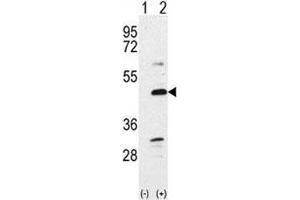 Western blot analysis of BMP7 antibody and 293 cell lysate either nontransfected (Lane 1) or transiently transfected with the BMP7 gene (2). (BMP7 anticorps  (AA 15-44))