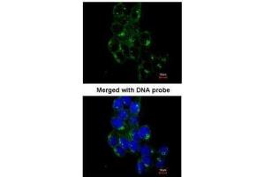 ICC/IF Image Immunofluorescence analysis of paraformaldehyde-fixed A431, using FYN, antibody at 1:200 dilution.