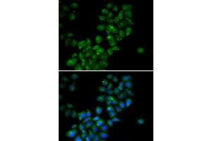 Immunofluorescence (IF) image for anti-Calcium Activated Nucleotidase 1 (CANT1) antibody (ABIN1980357)