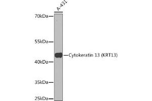 Western blot analysis of extracts of A-431 cells, using Cytokeratin 13 (Cytokeratin 13 (KRT13)) Rabbit pAb (ABIN7268090) at 1:1000 dilution.