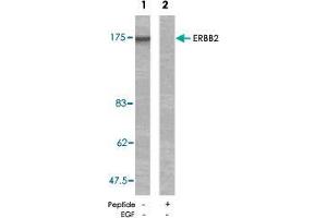Western blot analysis of extracts from MDA-MB-231 cells using ERBB2 polyclonal antibody  . (ErbB2/Her2 anticorps)