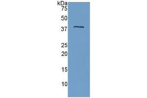 WB of Protein Standard: different control antibodies  against Highly purified E. (APOH Kit ELISA)