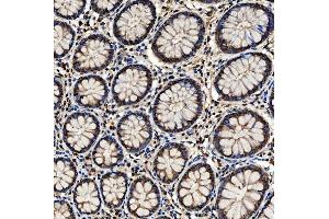 IHC analysis of SNF2H/SMARCA5 using anti-SNF2H/SMARCA5 antibody (ABIN7602001).