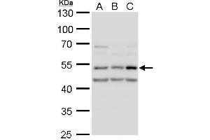 WB Image CaMK2D antibody detects CaMK2D protein by western blot analysis. (CAMK2D anticorps)