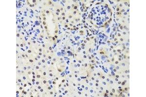 Immunohistochemistry of paraffin-embedded Mouse kidney using EFTUD2 Polyclonal Antibody at dilution of 1:100 (40x lens).