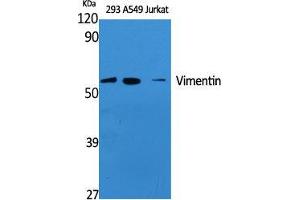 Western Blot (WB) analysis of specific cells using Vimentin Polyclonal Antibody. (Vimentin anticorps  (Tyr321))