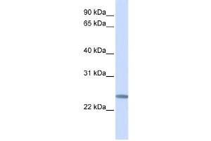 Western Blotting (WB) image for anti-Chromosome 12 Open Reading Frame 49 (C12orf49) antibody (ABIN2459339) (C12orf49 anticorps)