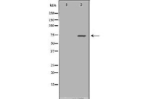 Western blot analysis of Hela whole cell lysates, using SDHA Antibody.