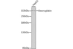 Western blot analysis of extracts of HepG2 cells, using Desmoplakin antibody (ABIN6134105, ABIN6139837, ABIN6139839 and ABIN6217243) at 1:800 dilution. (Desmoplakin anticorps  (AA 2750-2850))
