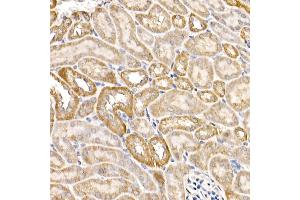Immunohistochemistry of paraffin-embedded Mouse kidney using  antibody (ABIN6129864, ABIN6136458, ABIN6136459 and ABIN6222564) at dilution of 1:50 (40x lens).