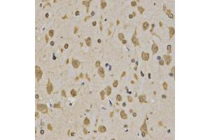 Immunohistochemistry of paraffin-embedded rat brain using Trimethyl-Histone H3-K4 antibody (ABIN5969804) at dilution of 1/200 (40x lens). (Histone 3 anticorps  (H3K4me3))