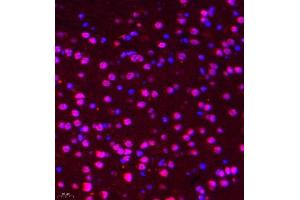 Immunofluorescence of paraffin embedded mouse brain using DGKI (ABIN7073721) at dilution of 1:650 (400x lens) (DGKI anticorps)