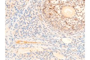 ABIN6267235 at 1/100 staining rat ovarian tissue sections by IHC-P.