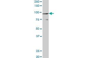 PCAF monoclonal antibody (M06), clone 5E5.
