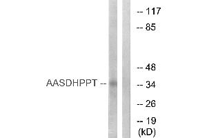 Western blot analysis of extracts from COLO cells, using AASDHPPT antibody. (AASDHPPT anticorps  (Internal Region))