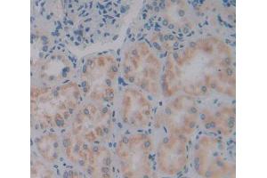 Used in DAB staining on fromalin fixed paraffin- embedded kidney tissue