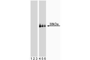 Western blot analysis of LAT (pY226) in human T lymphocytes. (LAT anticorps  (pTyr226))