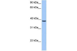 SUNC1 antibody used at 1 ug/ml to detect target protein. (SUN3 anticorps  (C-Term))