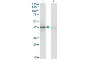 Western Blot analysis of SPO11 expression in transfected 293T cell line by SPO11 polyclonal antibody (A01). (SPO11 anticorps  (AA 291-395))