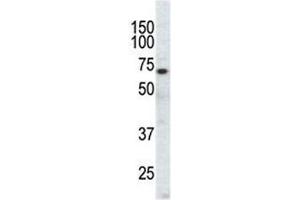 Western blot analysis of EphA3 antibody and CHO cell lysate.
