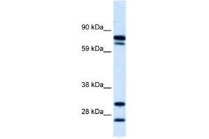 WB Suggested Anti-ZNF606 Antibody Titration:  0. (ZNF606 anticorps  (N-Term))