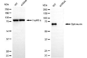 Western blotting analysis using optineurin antibody (ABIN7799705). (Recombinant OPTN anticorps)