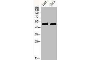 Western blot analysis of mouse-kidney mouse-brain mouse-lung mouse-heart 293T lysate, antibody was diluted at 1000.