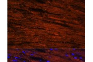 Immunofluorescence analysis of Rat heart cells using LDB3 Polyclonal Antibody at dilution of 1:100.