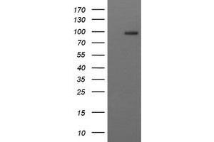 Image no. 2 for anti-CD22 Molecule (CD22) antibody (ABIN1497211) (CD22 anticorps)