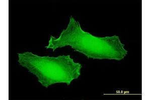 anti-Potassium Channel Tetramerisation Domain Containing 7 (KCTD7) (AA 1-289) antibody