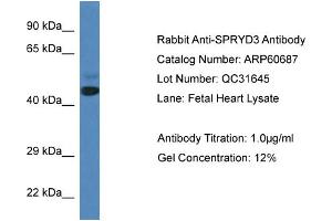 Western Blotting (WB) image for anti-SPRY Domain Containing 3 (SPRYD3) (N-Term) antibody (ABIN2788536) (SPRYD3 anticorps  (N-Term))
