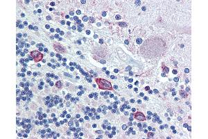 Anti-ERp72 antibody IHC of human brain, cerebellum.