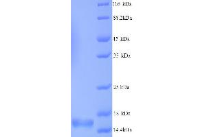 SDS-PAGE (SDS) image for Synuclein, alpha (SNCA) (AA 1-140), (full length) protein (His tag) (ABIN5713850)