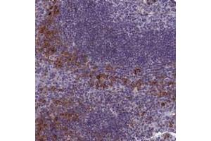 Immunohistochemical staining of human tonsil with CNEP1R1 polyclonal antibody  shows strong cytoplasmic positivity in subsets of cells outside germinal center at 1:20-1:50 dilution.