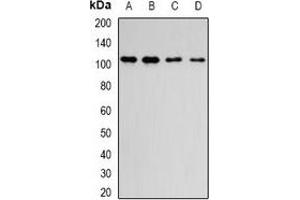 Western blot analysis of DPP8 expression in MCF7 (A), Hela (B), mouse brain (C), rat lung (D) whole cell lysates.