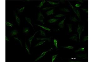 Immunofluorescence of monoclonal antibody to APOA2 on HeLa cell.