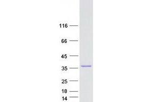 Validation with Western Blot