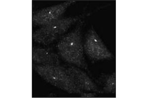 Immunofluorescence staining of Autophagy UVRAG Antibody  on Methanol-fixed HeLa cells. (UVRAG anticorps  (C-Term))