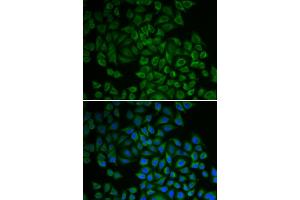 Immunofluorescence analysis of HeLa cells using SGK1 antibody (ABIN5970402). (SGK1 anticorps)